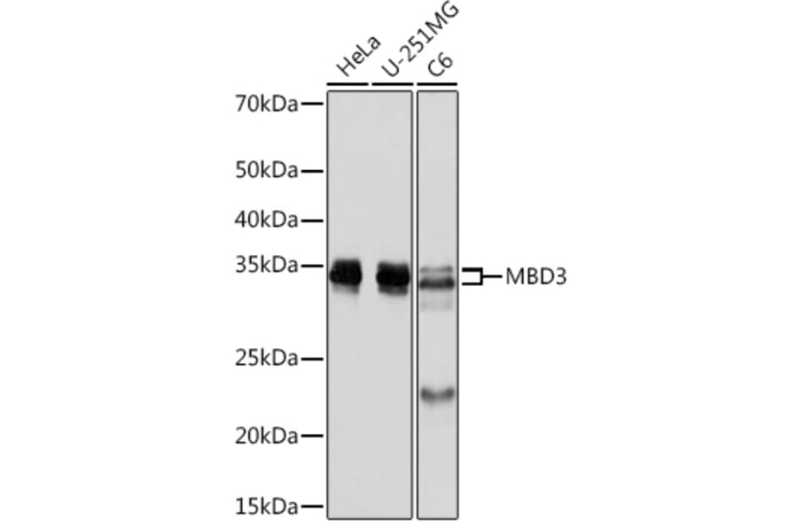 Western Blot - Anti-MBD3 Antibody [ARC2466] (A307276) - Antibodies.com