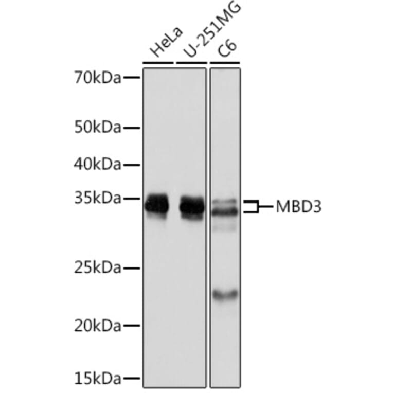 Western Blot - Anti-MBD3 Antibody [ARC2466] (A307276) - Antibodies.com