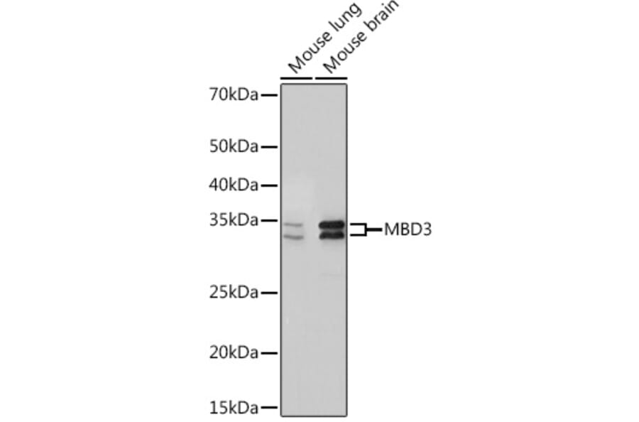 Western Blot - Anti-MBD3 Antibody [ARC2466] (A307276) - Antibodies.com