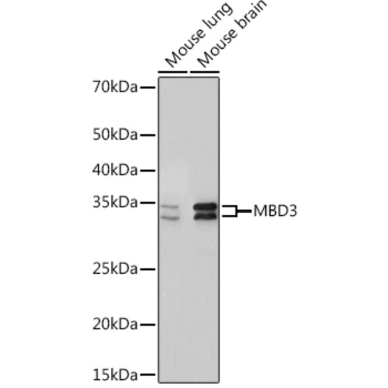 Western Blot - Anti-MBD3 Antibody [ARC2466] (A307276) - Antibodies.com