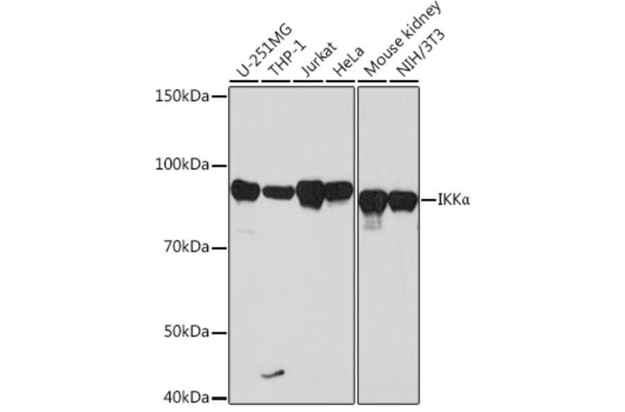 Western Blot - Anti-IKK alpha Antibody [ARC0174] (A307277) - Antibodies.com
