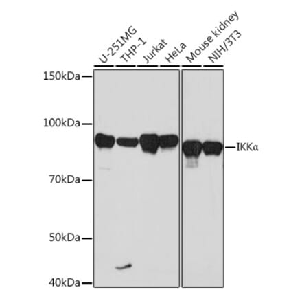 Western Blot - Anti-IKK alpha Antibody [ARC0174] (A307277) - Antibodies.com