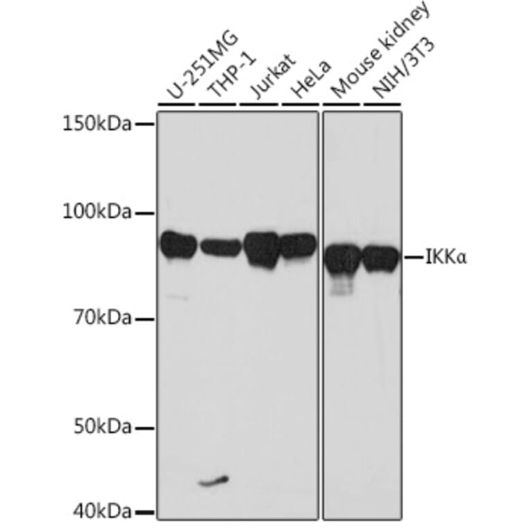 Western Blot - Anti-IKK alpha Antibody [ARC0174] (A307277) - Antibodies.com