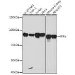 Western Blot - Anti-IKK alpha Antibody [ARC0174] (A307277) - Antibodies.com