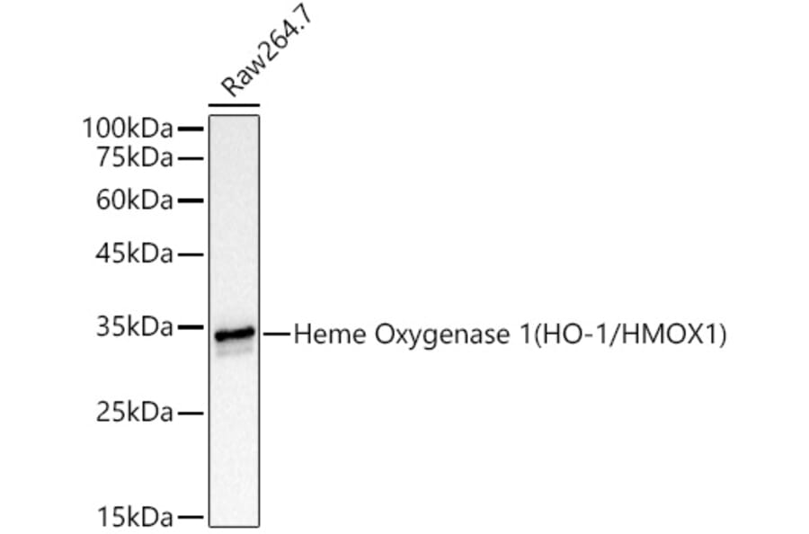 Western Blot - Anti-Heme Oxygenase 1 Antibody [ARC53508] (A307278) - Antibodies.com