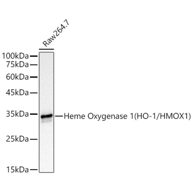 Western Blot - Anti-Heme Oxygenase 1 Antibody [ARC53508] (A307278) - Antibodies.com