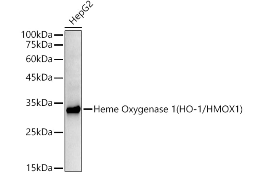 Western Blot - Anti-Heme Oxygenase 1 Antibody [ARC53508] (A307278) - Antibodies.com