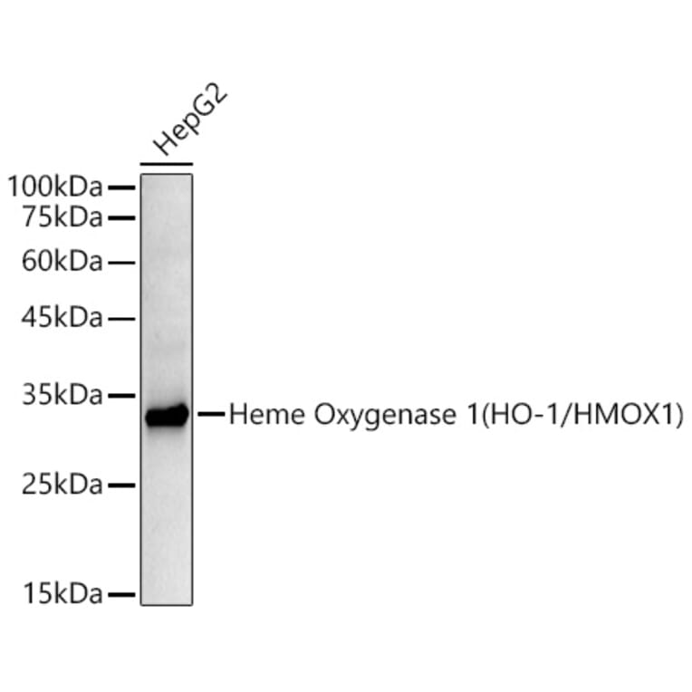Western Blot - Anti-Heme Oxygenase 1 Antibody [ARC53508] (A307278) - Antibodies.com