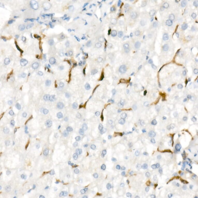Immunohistochemistry - Anti-Heme Oxygenase 1 Antibody [ARC53508] (A307278) - Antibodies.com
