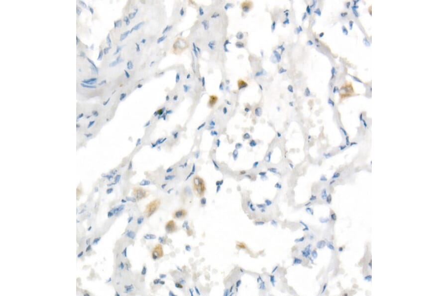 Immunohistochemistry - Anti-Heme Oxygenase 1 Antibody [ARC53508] (A307278) - Antibodies.com