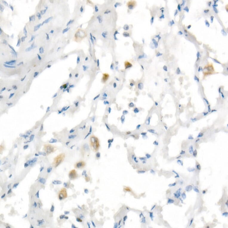 Immunohistochemistry - Anti-Heme Oxygenase 1 Antibody [ARC53508] (A307278) - Antibodies.com