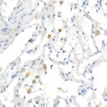 Immunohistochemistry - Anti-Heme Oxygenase 1 Antibody [ARC53508] (A307278) - Antibodies.com
