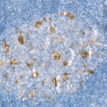 Immunohistochemistry - Anti-Heme Oxygenase 1 Antibody [ARC53508] (A307278) - Antibodies.com