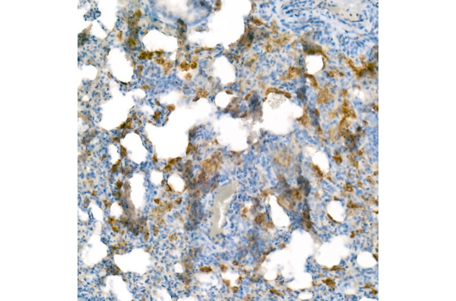 Immunohistochemistry - Anti-Heme Oxygenase 1 Antibody [ARC53508] (A307278) - Antibodies.com