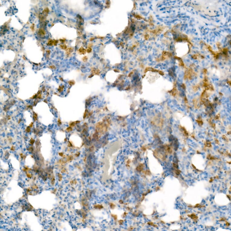 Immunohistochemistry - Anti-Heme Oxygenase 1 Antibody [ARC53508] (A307278) - Antibodies.com
