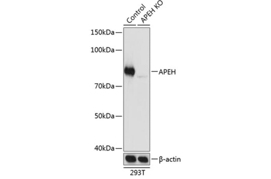 Western Blot - Anti-APH Antibody (A307280) - Antibodies.com