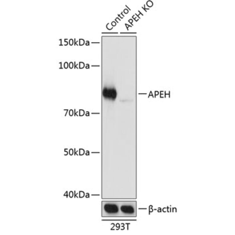 Western Blot - Anti-APH Antibody (A307280) - Antibodies.com
