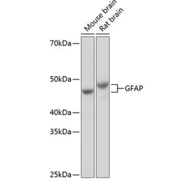 Western Blot - Anti-GFAP Antibody [ARC0206] (A307282) - Antibodies.com