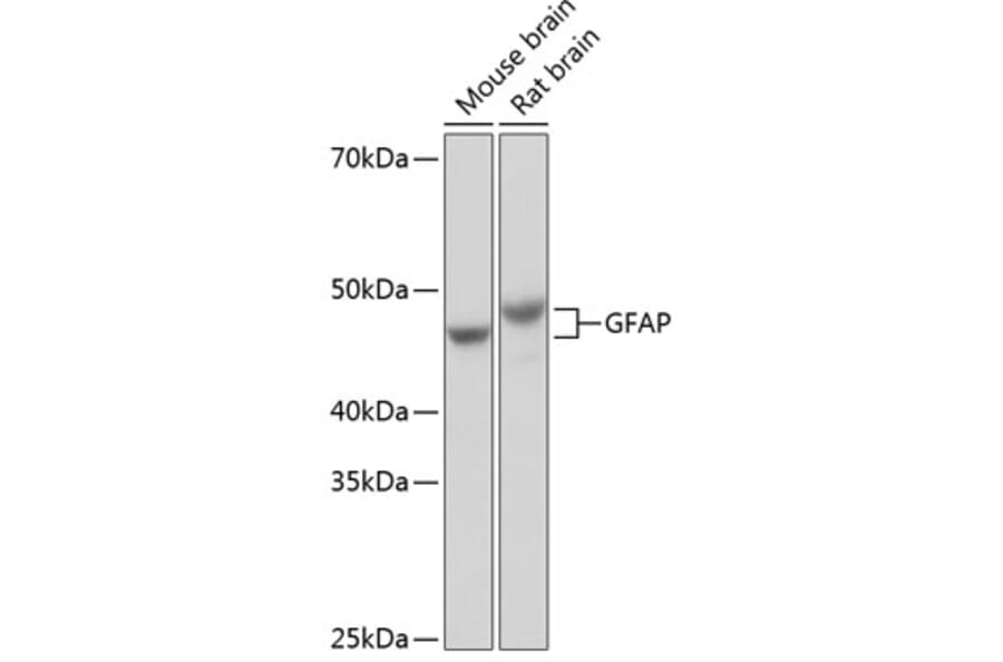 Western Blot - Anti-GFAP Antibody [ARC0206] (A307282) - Antibodies.com