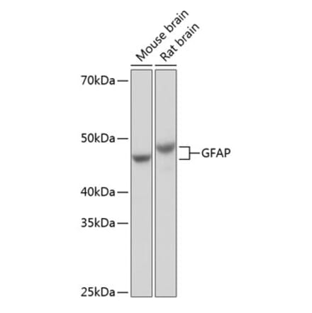 Western Blot - Anti-GFAP Antibody [ARC0206] (A307282) - Antibodies.com