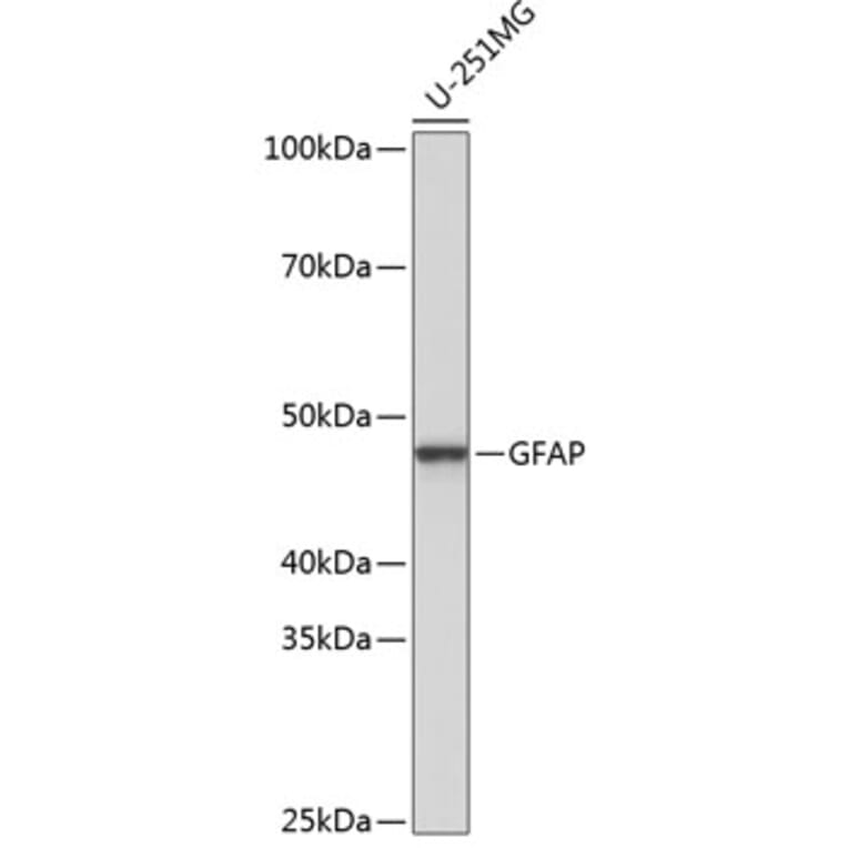 Western Blot - Anti-GFAP Antibody [ARC0206] (A307282) - Antibodies.com