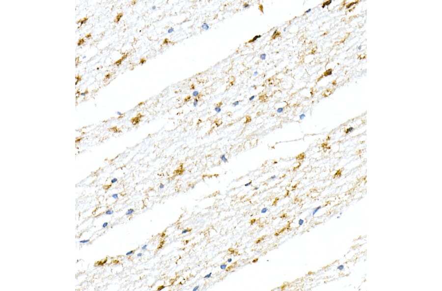 Immunohistochemistry - Anti-GFAP Antibody [ARC0206] (A307282) - Antibodies.com