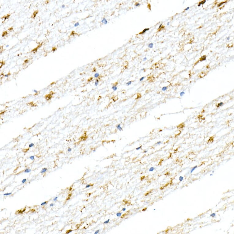 Immunohistochemistry - Anti-GFAP Antibody [ARC0206] (A307282) - Antibodies.com