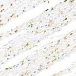 Immunohistochemistry - Anti-GFAP Antibody [ARC0206] (A307282) - Antibodies.com
