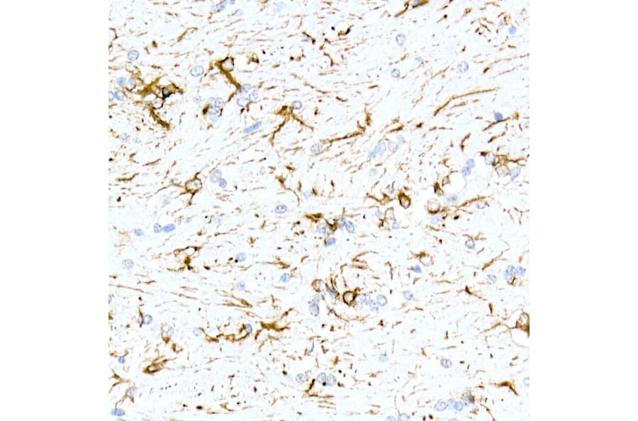 Immunohistochemistry - Anti-GFAP Antibody [ARC0206] (A307282) - Antibodies.com