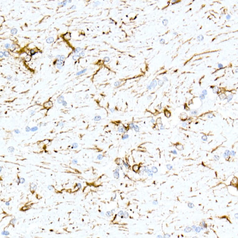 Immunohistochemistry - Anti-GFAP Antibody [ARC0206] (A307282) - Antibodies.com