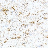 Immunohistochemistry - Anti-GFAP Antibody [ARC0206] (A307282) - Antibodies.com