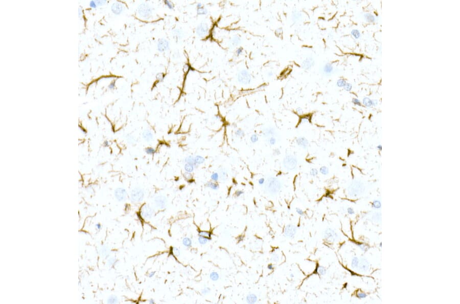 Immunohistochemistry - Anti-GFAP Antibody [ARC0206] (A307282) - Antibodies.com