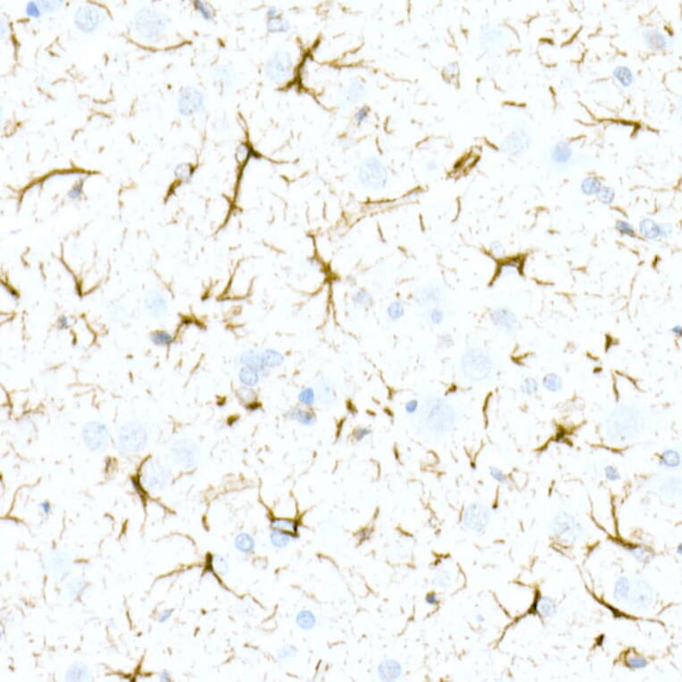 Immunohistochemistry - Anti-GFAP Antibody [ARC0206] (A307282) - Antibodies.com