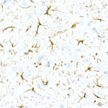 Immunohistochemistry - Anti-GFAP Antibody [ARC0206] (A307282) - Antibodies.com