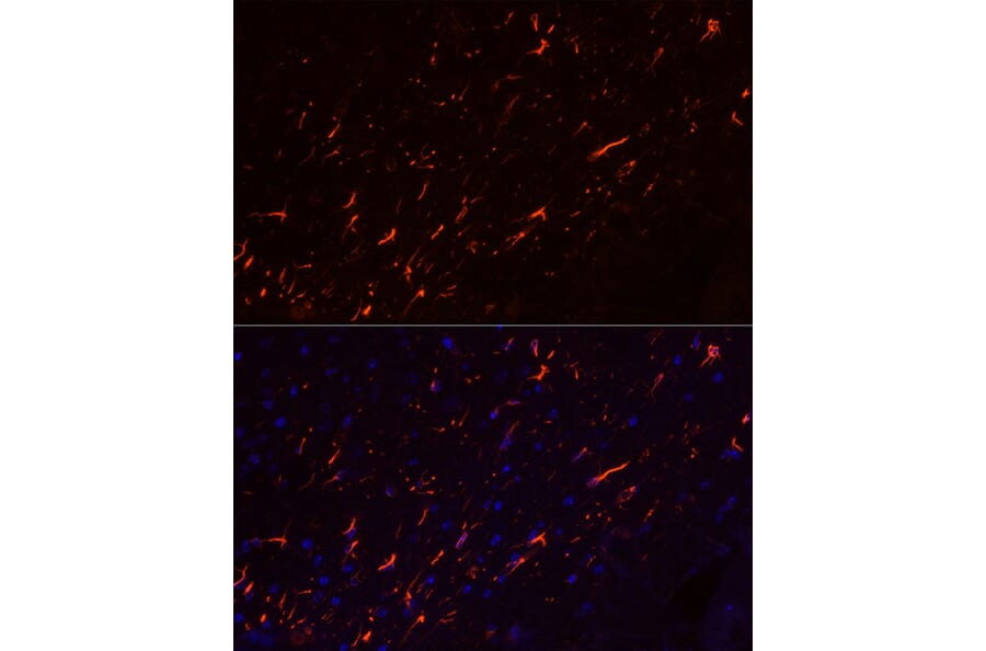 Immunofluorescence - Anti-GFAP Antibody [ARC0206] (A307282) - Antibodies.com