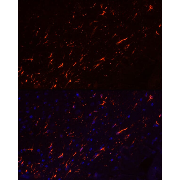 Immunofluorescence - Anti-GFAP Antibody [ARC0206] (A307282) - Antibodies.com