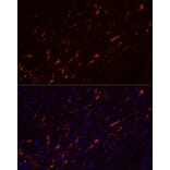 Immunofluorescence - Anti-GFAP Antibody [ARC0206] (A307282) - Antibodies.com