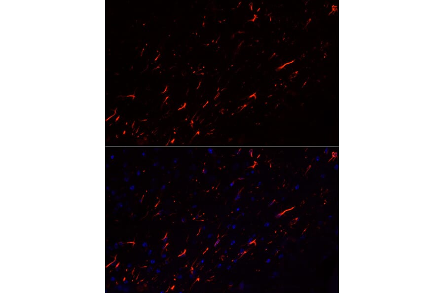 Immunofluorescence - Anti-GFAP Antibody [ARC0206] (A307282) - Antibodies.com