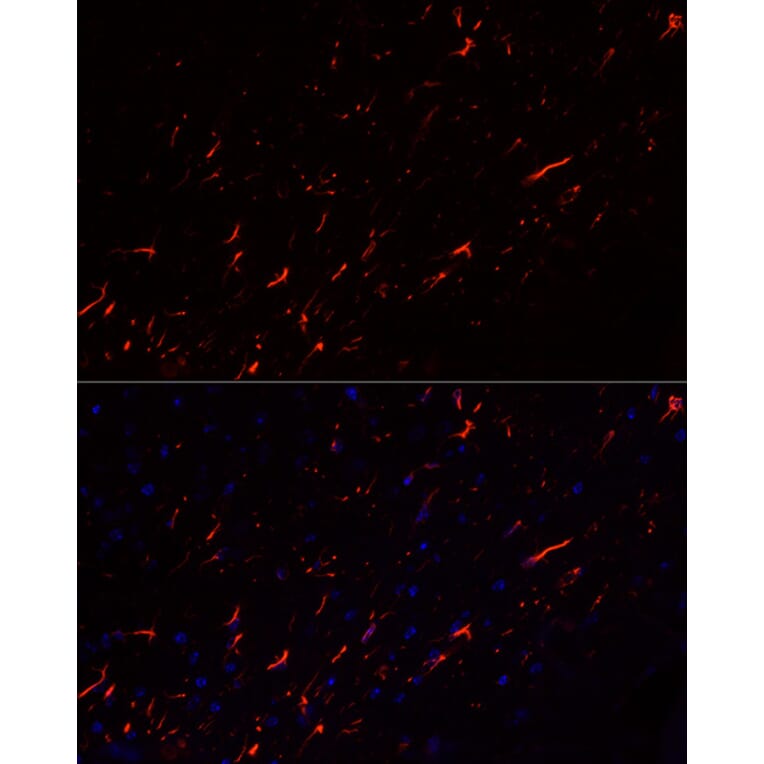 Immunofluorescence - Anti-GFAP Antibody [ARC0206] (A307282) - Antibodies.com