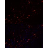 Immunofluorescence - Anti-GFAP Antibody [ARC0206] (A307282) - Antibodies.com