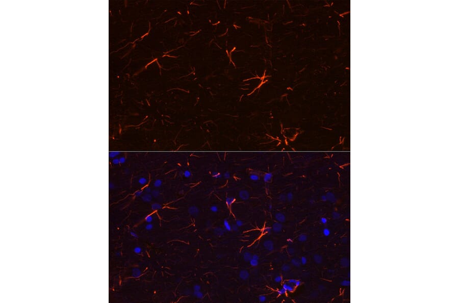 Immunofluorescence - Anti-GFAP Antibody [ARC0206] (A307282) - Antibodies.com