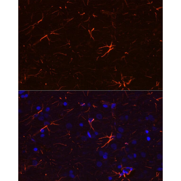 Immunofluorescence - Anti-GFAP Antibody [ARC0206] (A307282) - Antibodies.com