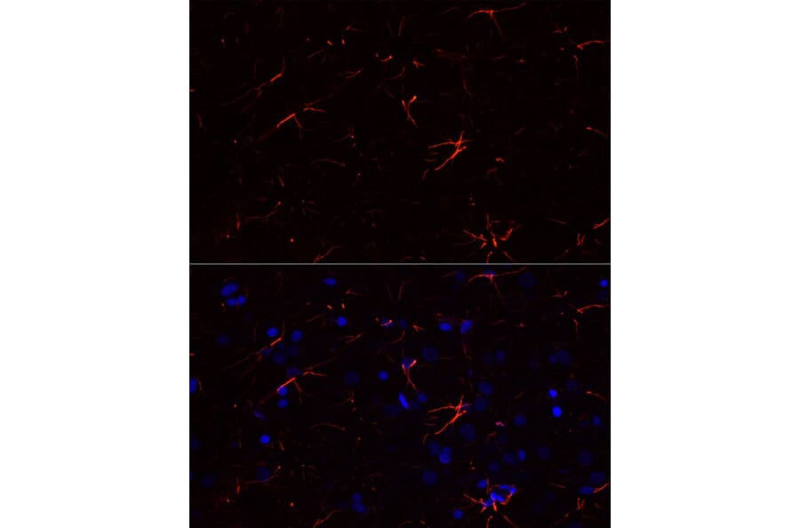 Immunofluorescence - Anti-GFAP Antibody [ARC0206] (A307282) - Antibodies.com