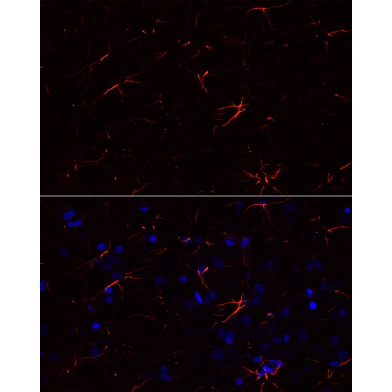 Immunofluorescence - Anti-GFAP Antibody [ARC0206] (A307282) - Antibodies.com