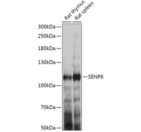 Western Blot - Anti-SENP6 Antibody (A307283) - Antibodies.com