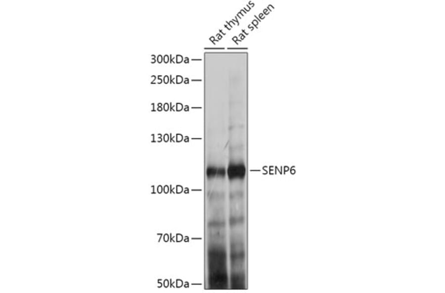 Western Blot - Anti-SENP6 Antibody (A307283) - Antibodies.com