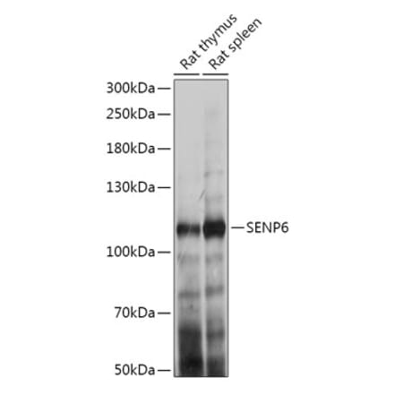 Western Blot - Anti-SENP6 Antibody (A307283) - Antibodies.com