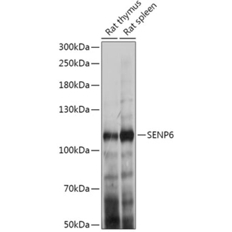 Western Blot - Anti-SENP6 Antibody (A307283) - Antibodies.com
