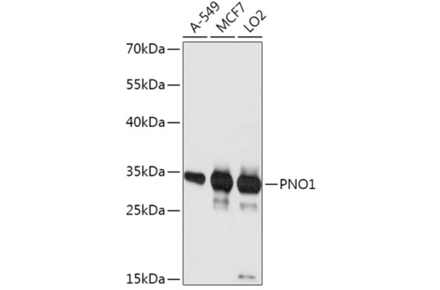 Western Blot - Anti-PNO1 Antibody (A307284) - Antibodies.com
