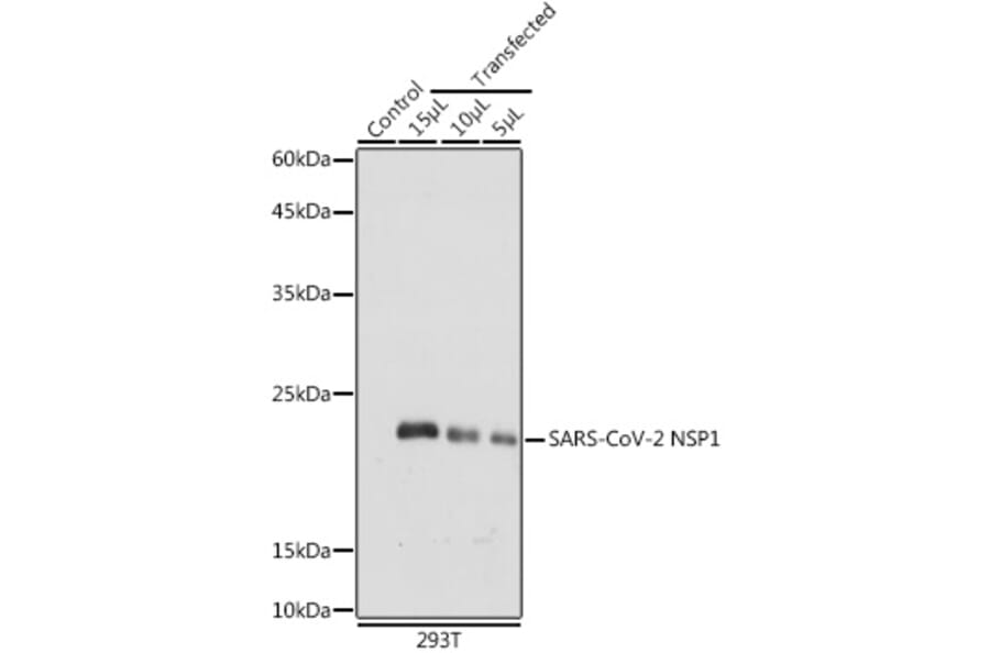 Western Blot - Anti-SARS-CoV-2 NSP1 Antibody (A307286) - Antibodies.com